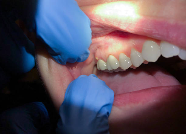 Best Cosmetic Emergency Dentistry in Middlebury, IN