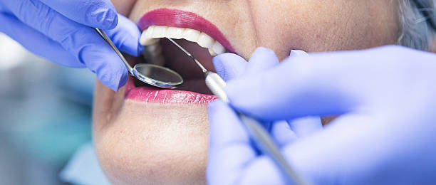 Best Emergency Treatment for Dental Infections or Abscesses in Middlebury, IN